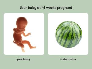 Week 41 of Pregnancy | Induction of Labour & Post-Dates Pregnancy